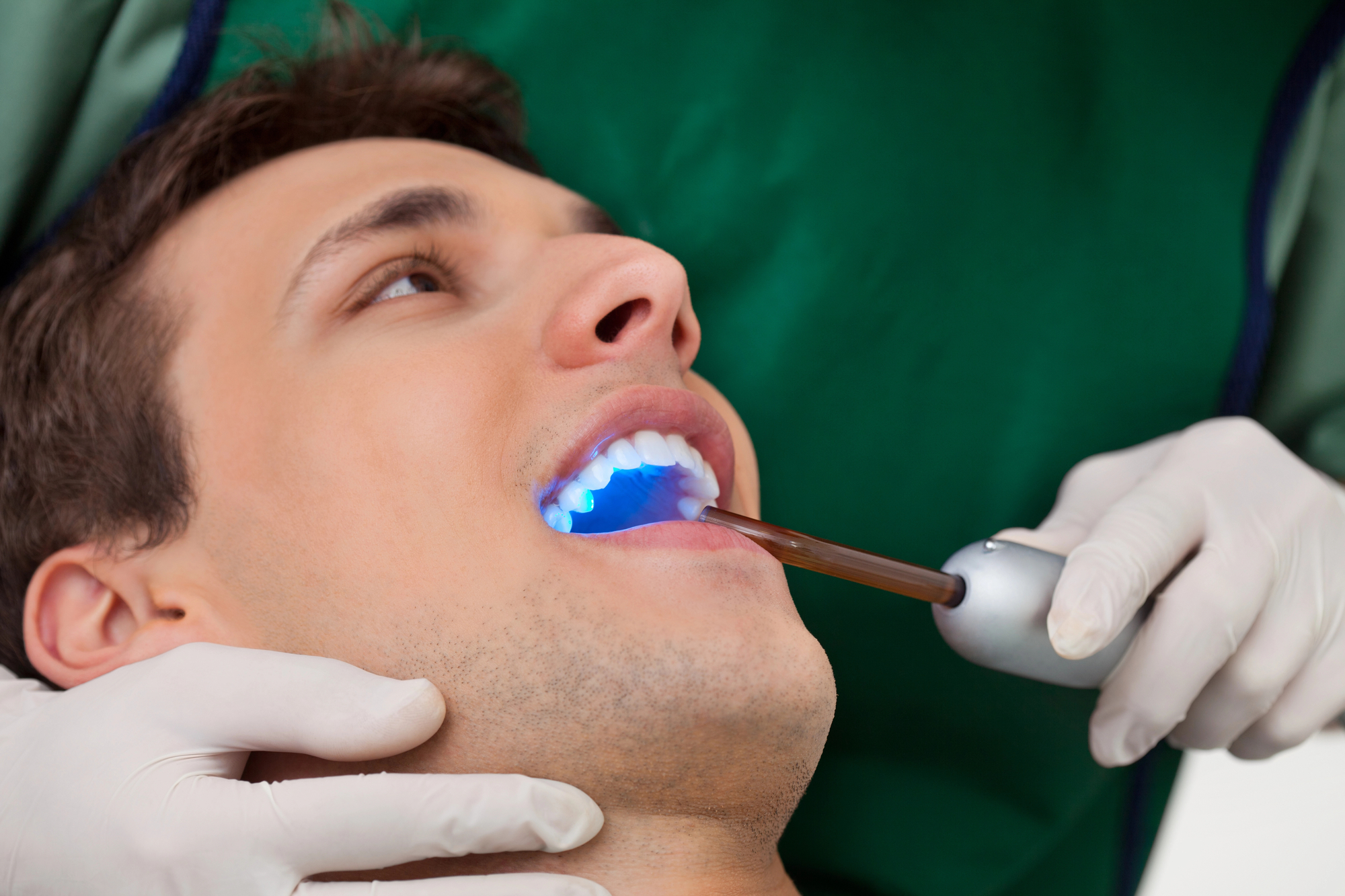 Cosmetic Bonding in Bolingbrook, IL