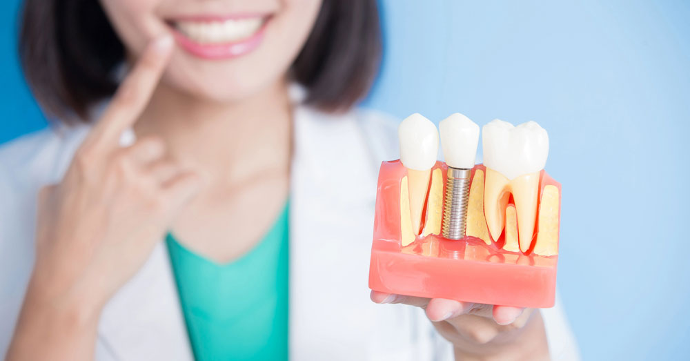 Can I Get Dental Implants with Bone Loss?