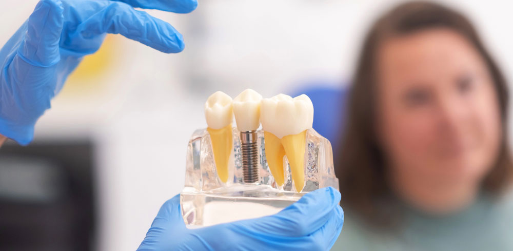 Implant Solutions When Bone Loss Is Significant